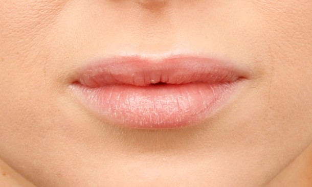 Lippen aufspritzen Düsseldorf